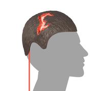 MedEduQuest Wearable Head Wound Care Kit, Stop The Bleed Training Kit for Medical Students, First Aid, Wound Training and Medical Classes - Brown