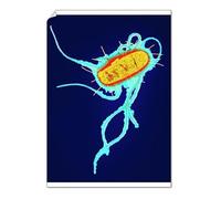 Media Storehouse Coloured TEM Print of E. coli Bacterium - Poster Print A2 (59.4 x 42cm) (6276469)