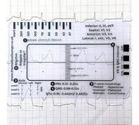 Medical ECG Ruler Card, Professional Healthcare Measuring Tool, Heart Rate and QRS Analysis Guide