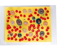 Medical Gift, Blood Cell Teaching Model, Vascular System Model, Assembly Anatomical Model, Red Blood Cells White Blood Cells Teaching, for Educational Training Anatomy Bio.