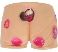 Medical Gift, Pressure Ulcer Wound Model, Advanced Pressure Bedsores Ulcers Nursing Model, Pressure Ulcer Models of Different Degrees Elder Butt Model, for Medical Training.