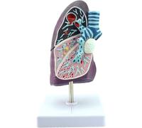 Medical Human Pathological Lung Model Internal Medicine Model Lung Model Lung Anatomy Respiratory System Model Human Lung Anatomical Model - Pathological Tuberculosis Pneumonia
