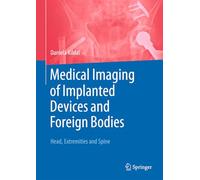 Medical Imaging of Implanted Devices and Foreign Bodies: Head, Extremities and Spine