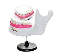 Medical Models, Dental Teeth Model-Dental Dentition and Molar Anatomy Model,Demonstration Tooth Model for Patient Education,Medical School Student Training Aid