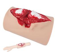 Medical Training Model for Tibial Fracture Trauma, Simulates Bleeding and Wound Packing, Wearable Design for Clinical Education and Doctor Practice