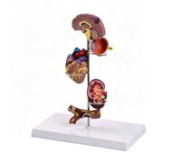 Medicals Education Model Good for Understanding Diabete Hypertensions on Human Body Hyperglycemia Hypertensions Model