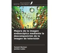 Mejora de la imagen endoscópica mediante la descomposición de la imagen de televisión