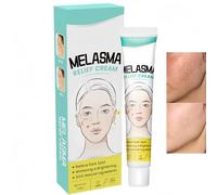 Mel/asma Treatment Cream,Dark Spot Remover for Face & Body,Dark Spot Corrector Cream,Pigmentation Removal Cre/am,Dark Spot Correcting Glow Serum for Age Spo/ts & Freckles,Anti Redness Cre/am