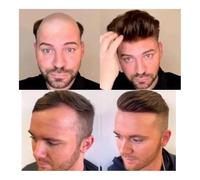 Men Bun Wig 0.04MM Ultra Thin Skin Men Hairpiece Knotless Wig Male Full V-Looped Hair On Base Toupee Men's Wig Capillary Prosthesis Hair Wig For Men(#2+20% WHITE)