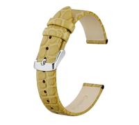 MENGKE Luxury Genuine Leather Watch Straps Women 8mm 10mm 12mm 14mm 16mm 18mm 19mm 20mm For Lady Replacement Band Bracelet(Yellow,20mm)