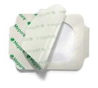 Mepore 273000 Film Dressing, Vapour-Permeable Adhesive Film Sterile, 15 cm x 20 cm (Pack of 10)