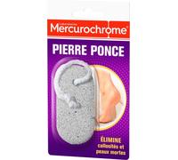 Mercurochrome 050938 Set of 2 Pumice Stones