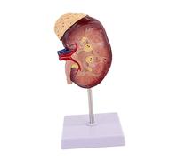 MERIGLARE Human Kidney Model with Base Model for Biology Study Class Accessory