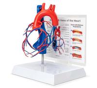 Merinden Human Heart Vascular Model, Life Size Cardiovascular Model Showing The Arteries and Veins with Base for Medical Classroom and Cardiology Study