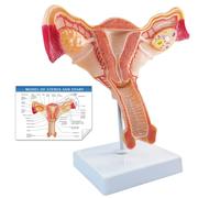 Merinden Human Uterus and Ovary Anatomical Model, Life-Size Realistic Female Anatomical Organs for Medical Science Education Study or Teaching