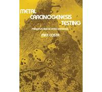 Metal Carcinogenesis Testing: Principles and In Vitro Methods (Biological Methods)