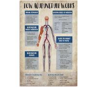 Metal Tin Sign- Acupuncture Knowledge Metal Tin Signs How Acupuncture Works Posters Beginner's Guide to Acupuncture Plaques Clinic Home Room Wall Decor 8x12 Inch
