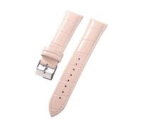 MFXFKOKGAX Universal Watchband Strap Bamboo Joint Pattern 18mm 20mm 22mm Men Women Waterproof Bracelet Watch Accessories(Pink,22mm)