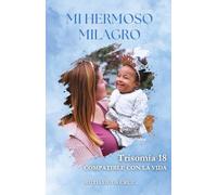 Mi Hermoso Milagro: Trisomia 18 Compatible Con La Vida