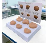 MiBoce Level 1-6 Prostate Palpation Model, Male Prostate Model, Multi-lesion Prostate Model with Mass, Contrast Normal Prostate And Prostate Cancer Model, Visual Teaching Aids
