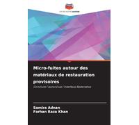 Micro-fuites autour des matériaux de restauration provisoires: Conclure l'accord via l'interface Restorative