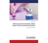 Microcrack Formation After Root Canal Instrumentation: A Literature Review