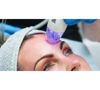Microneedling Up to 2mm depth with RF and using Hyaluronic Acid. Single Session