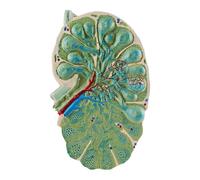 Microstructure Human Lymph Node Model, Lymph Node Enlargement Anatomical Models,Shape Is Realistic Medical Specimen Biology Teaching Tool For Science Study Display