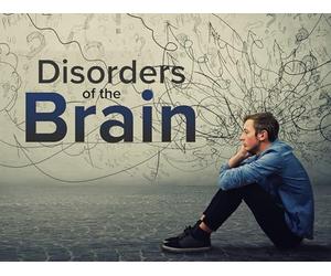 Mild Cognitive Impairment