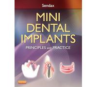 Mini Dental Implants: Principles and Practice
