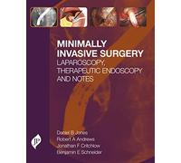 Minimally Invasive Surgery: Laparoscopy, Therapeutic Endoscopy and NOTES
