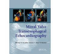 Mitral Valve Transesophageal Echocardiography