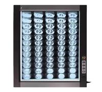 Mixtric Lab Equipment X-Ray Film Illuminator Light Box X-Ray Viewer Light Panel Screen, Professional Slide Viewer Illuminator with Optical Acrylic Diffuser for Home and Lab Use,45 * 50 * 2.5cm