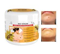 MLqkpwy BeeVenom Skin Cream, BeeVenom Repair Cream, 30g BeeVenom TreatmentCream, Professional BeeVenom Repair Cream For Skin Tags, BeeVenom Wart & Moles Removal Cream Skin Moisturiser