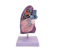 Model of a Smoke Lung 2:3 Human Lung Anatomical Model wirh Pathological Features Clear Texture Accurate Anatomy Structure for Teaching