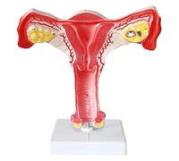Model Of Female Internal And External Organs, Uterine Lesion, Anatomical Model Of The Uterus, Human Anatomy, Scientific Models, 102 Anatomical Model