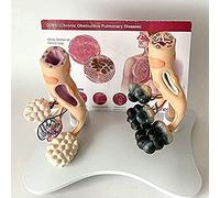 ModelHealthy Lung and Pathological Comparison ModelClassroom for Doctor Patient Education Anatomical Model