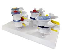 Models Anatomy Model Four-Point Lumbar Normal and Lumbar and Lesion Combination Model Human Anatomical Lumbar Medical Model Body for Lab Equipment Study Teaching Medical Teaching Medical Gift
