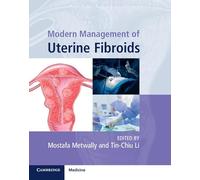 Modern Management of Uterine Fibroids