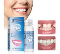 Moldable False Teeth Tooth Repair Granules, Teeth Repair Kit, Diy Temporary Tooth Repair Beads
