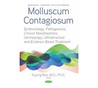 Molluscum Contagiosum: Epidemiology, Pathogenesis, Clinical Manifestations, Dermoscopy, Ultrastructure and Evidence Based Treatment