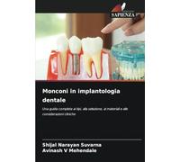 Monconi in implantologia dentale: Una guida completa ai tipi, alla selezione, ai materiali e alle considerazioni cliniche