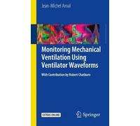 Monitoring Mechanical Ventilation Using Ventilator Waveforms - 9783319586540