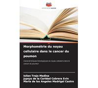 Morphométrie du noyau cellulaire dans le cancer du poumon: Caractéristiques histologiques du noyau cellulaire dans le cancer du poumon