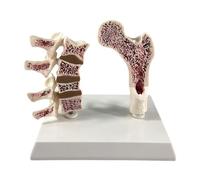 MotiveTech Femur Osteoporosis Model, Include Leg Bones And Spine, Versatile Learning Resources Props Educational Tool