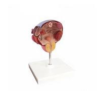 MotiveTech Human Model Educational Correct for Students, Teachers, Classroom, Health Center, Research Facility, Pathological Bladder Model