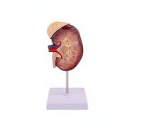 MotiveTech Human Model Educational Correct for Students, Teachers, Classroom, Health Center, Research Facility, 2 Times Enlarged Kidney Model