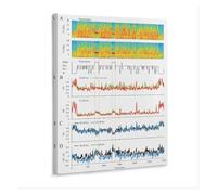 MQXFCZUX Brain Activity During Sleep Poster - EEG Recordings & Stages Chart, Neuroscience Decor for Home Office & Lab Unframed,08x12inch(20x30cm)