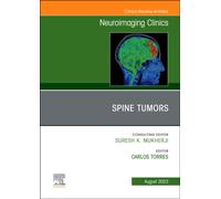 MRI and Traumatic Brain Injury, An Issue of Neuroimaging Clinics of North America : Volume 33-2