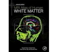 MRI Atlas of Human White Matter
